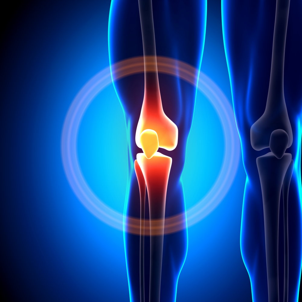 Knie Knie